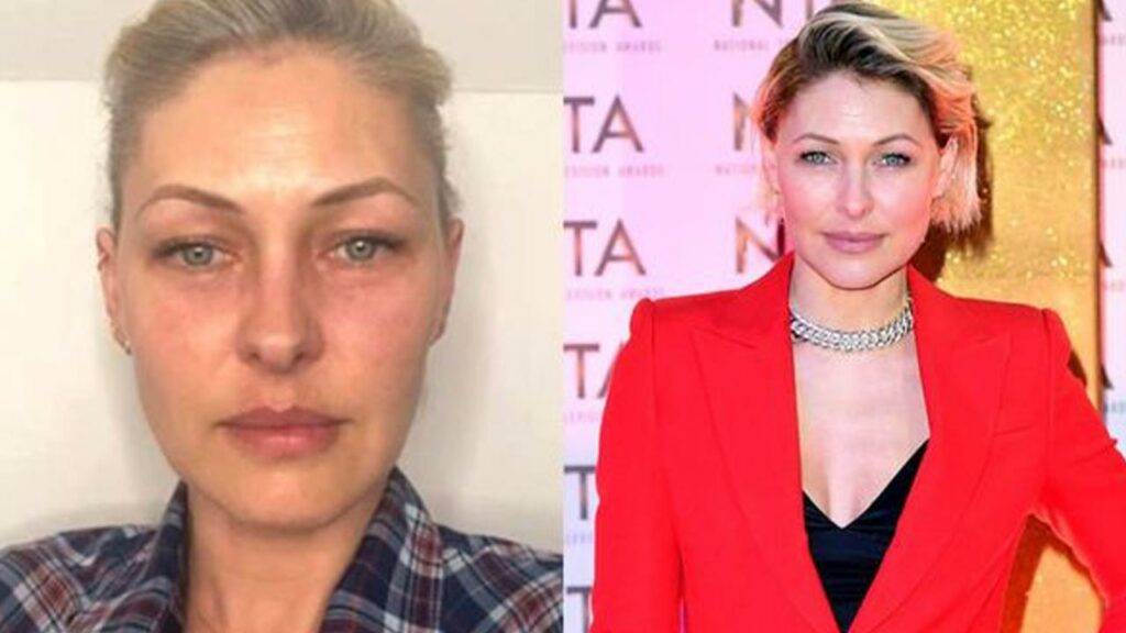 Emma Willis Allegations