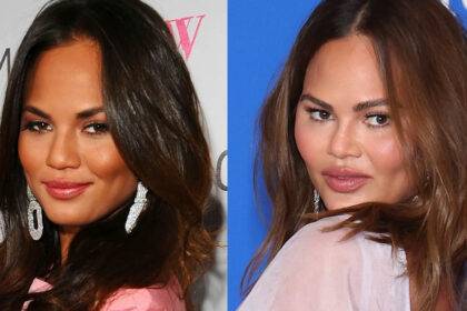 Chrissy Teigen Plastic Surgery