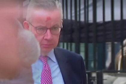 Michael Gove Face And Forehead Injury News