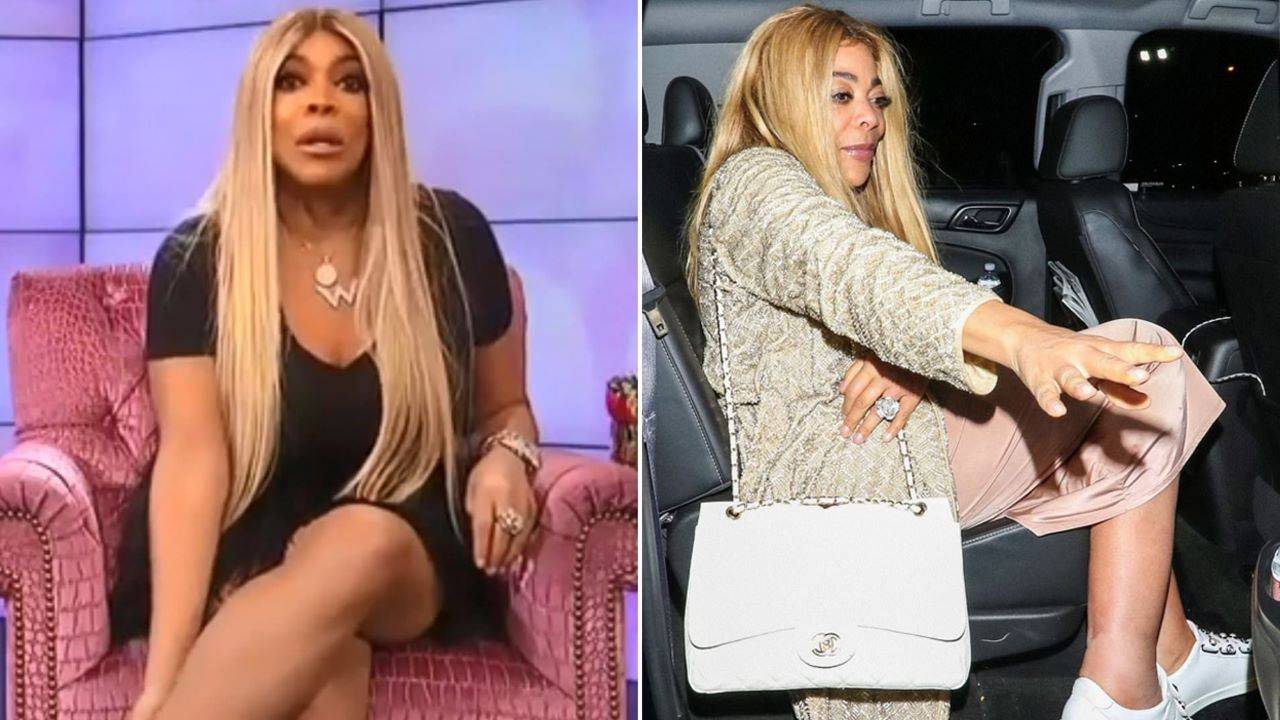 Wendy Williams Legs Problems