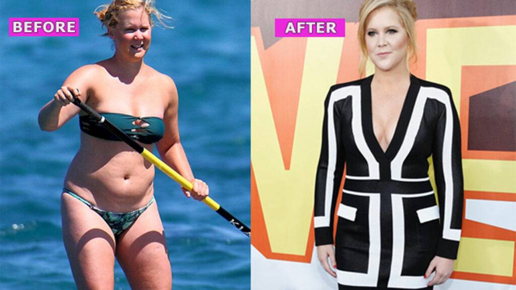 Amy Schumer