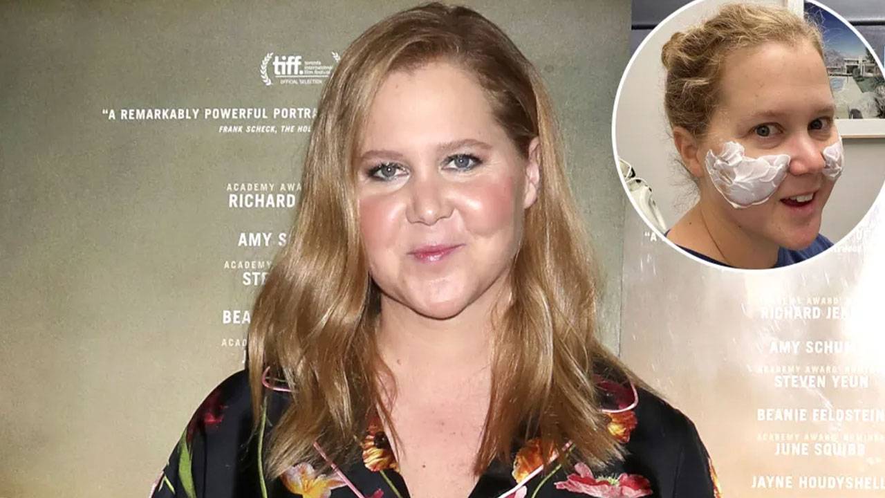 Amy Schumer Cheeks And Fat Face