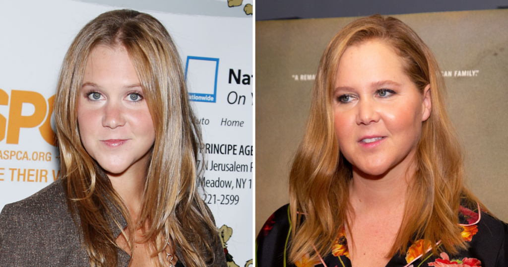 Amy Schumer Face Shape Change