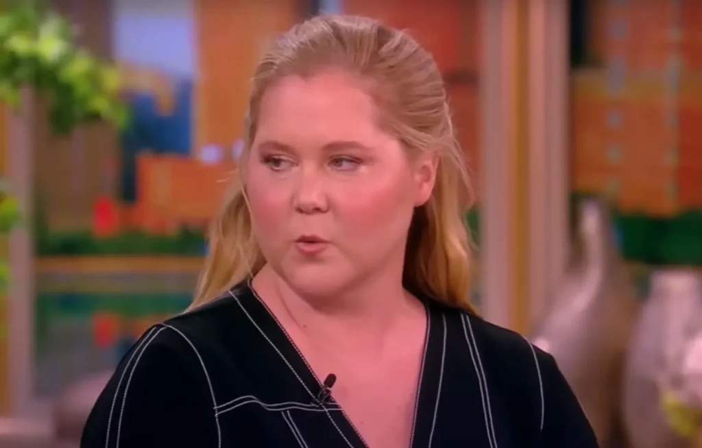 Amy Schumer Puffy Face