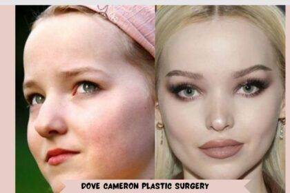 Dove Cameron Plastic Surgery