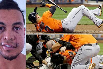 Giancarlo Stanton Face Injury