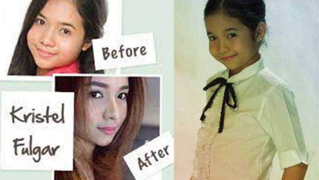 Kristel Fulgar Before And Now