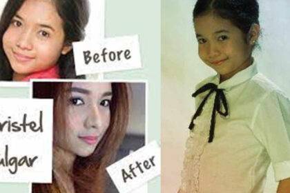 Kristel Fulgar Befor And Now